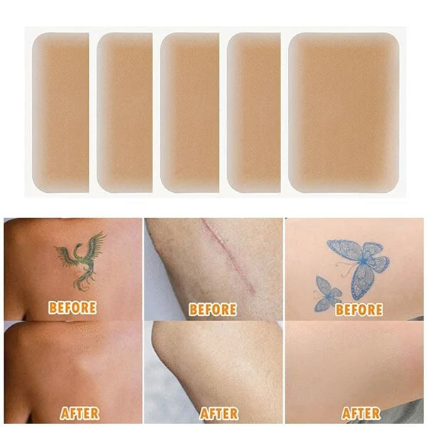 Skin Invisible Scar Stickers