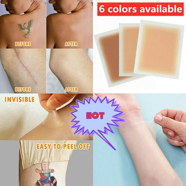 Skin Invisible Scar Stickers